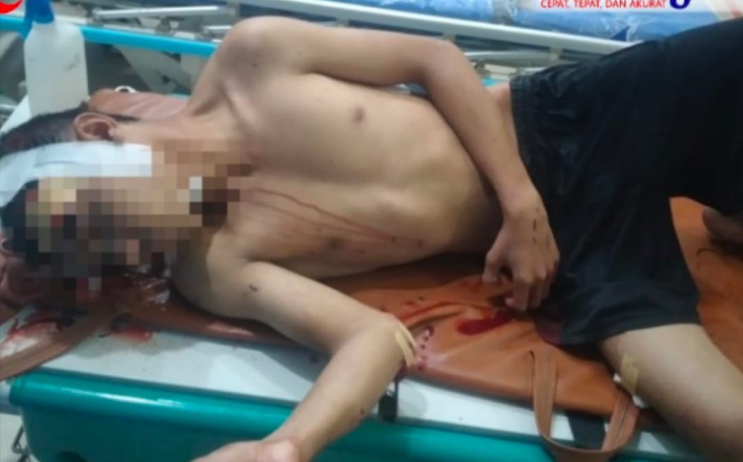 Sadis..!! Gerombolan Begal Bacok Warga Panah Hijau, Sepeda Motor Disikat