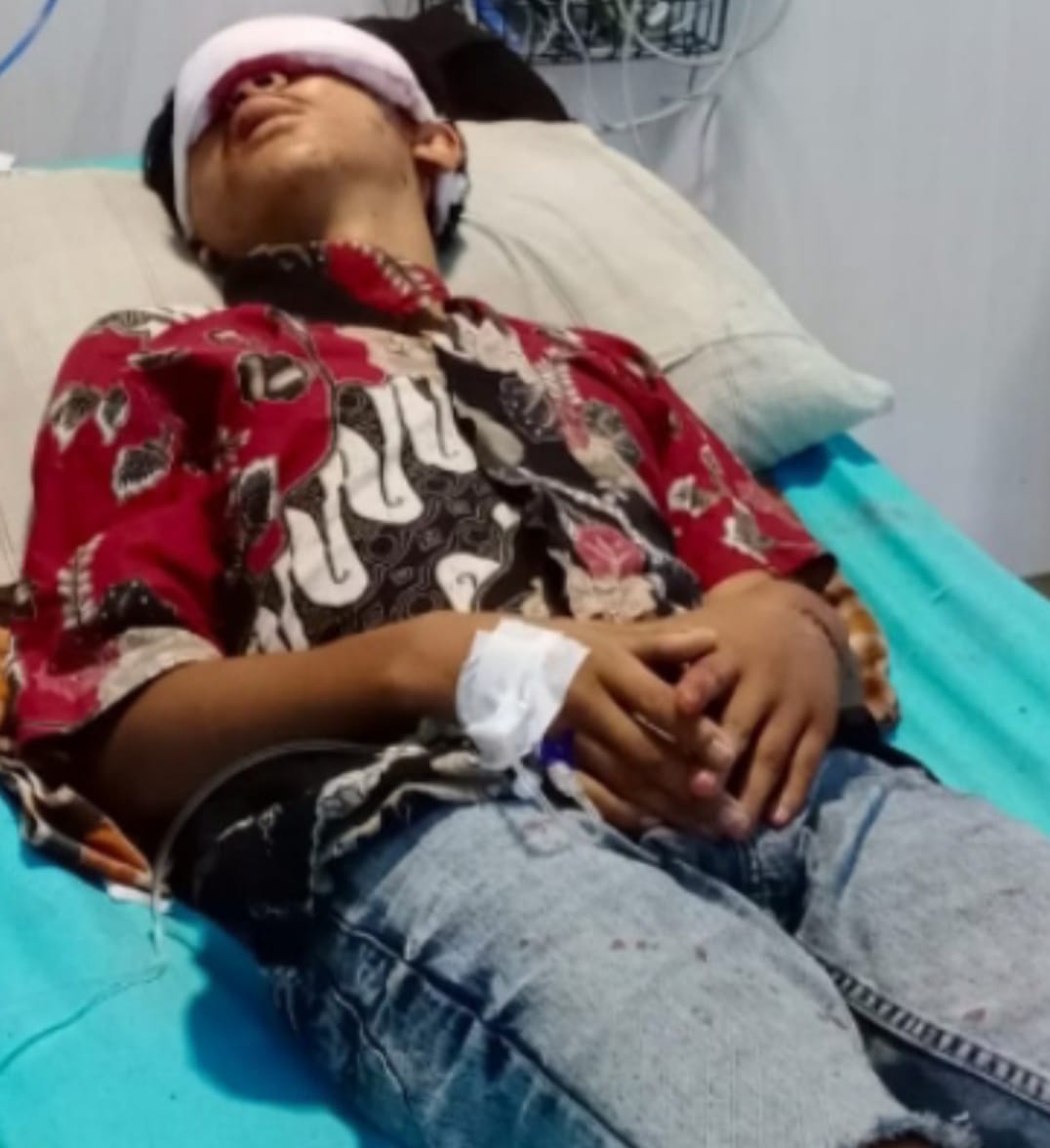 Seorang Remaja Dicelurit 2 Pria, Laporan Ditolak SPKT Polres Pelabuhan Belawan