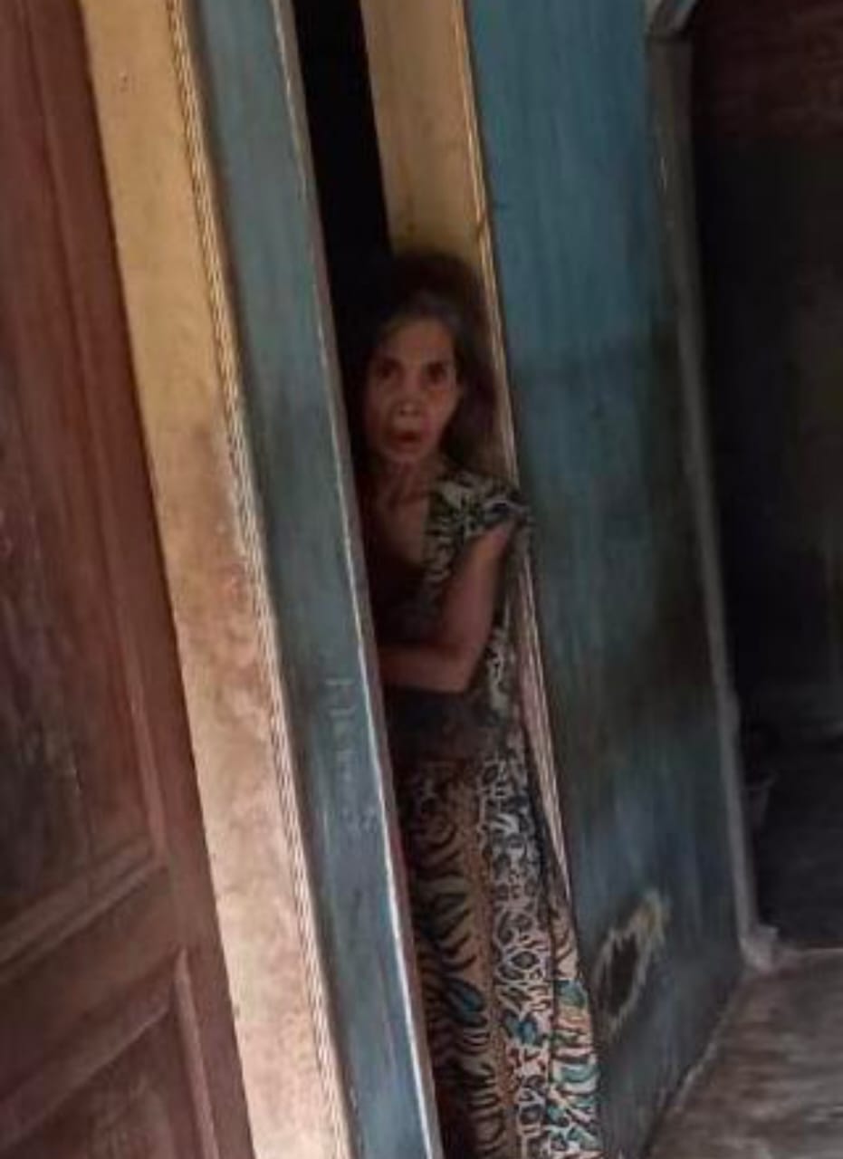 Pilu!! Sumiati Sudah Lama Menderita Penyakit, Tak Pernah Dapat Bantuan Pemerintah
