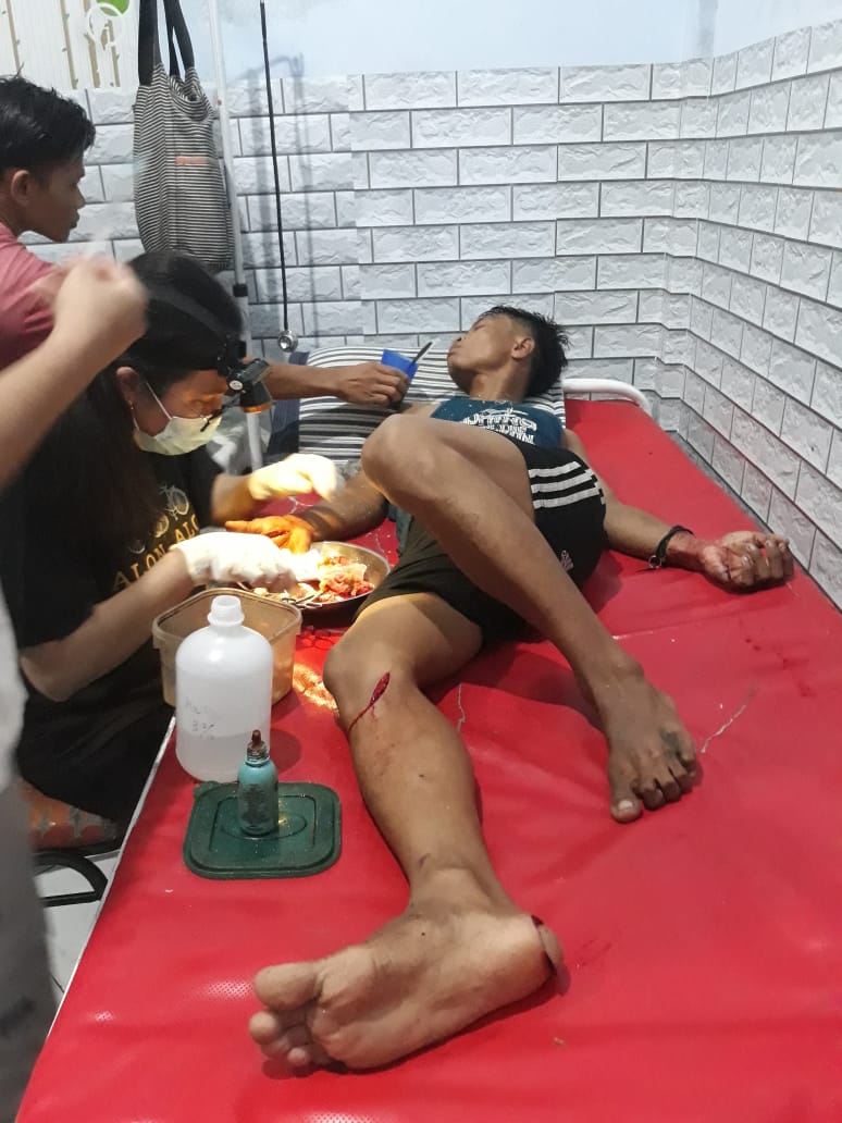 17 Bulan Pelaku Penganiayaan Terhadap Muhammad Fauzi Ikbal Belum Juga Tertangkap