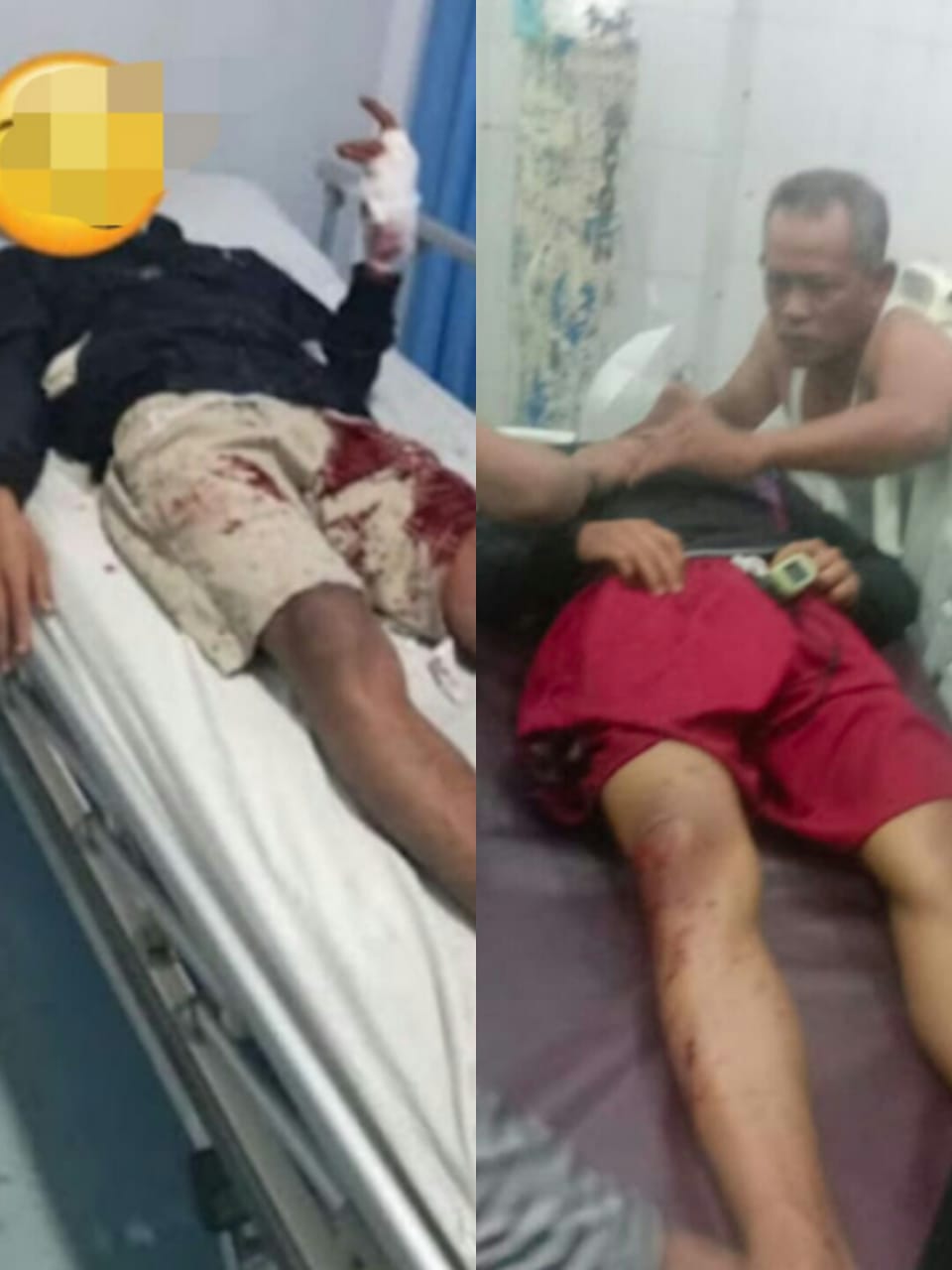 Aksi Begal memakan korban, 1 Orang Meninggal, 1 Orang Kritis