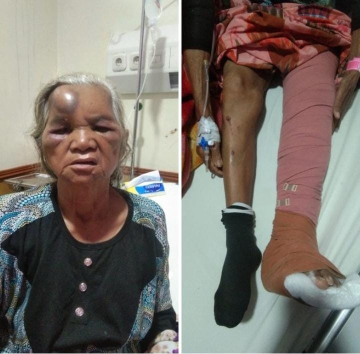 Mobil Box Indomaret Hantam Betor, Seorang Nenek Penumpang Betor Masuk RSUD Adam Malik