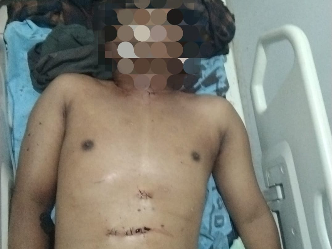 Diduga Cekcok Dengan Isteri, Pria di Langkat Nekat Tikam Perut dan Gorok Leher Sendiri