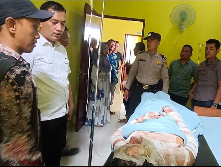 Seorang Suami di Langkat Tega Siram Bensin dan Bakar Istrinya