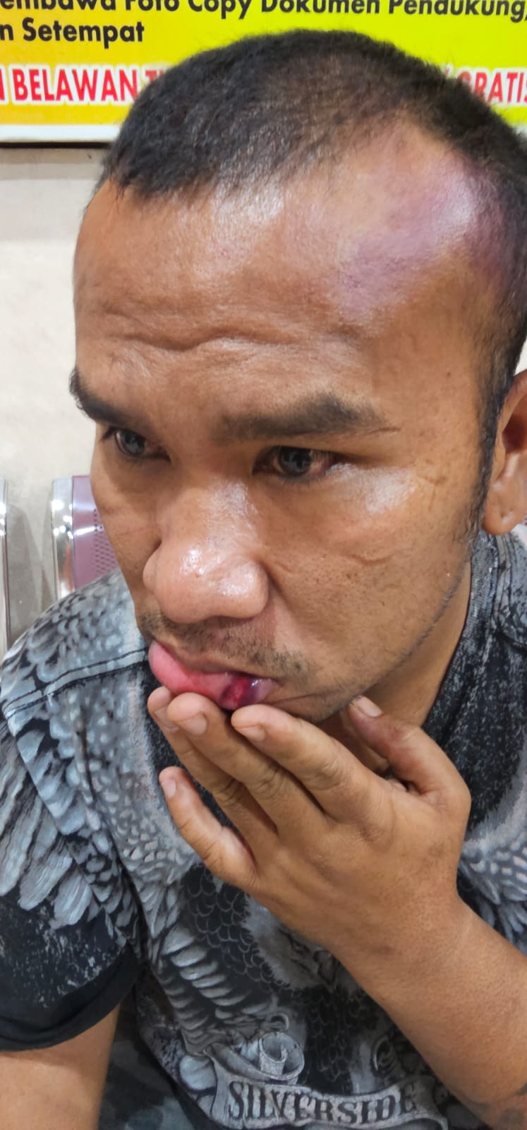 Pesta Tahun Baru Berujung Keributan di Medan Labuhan